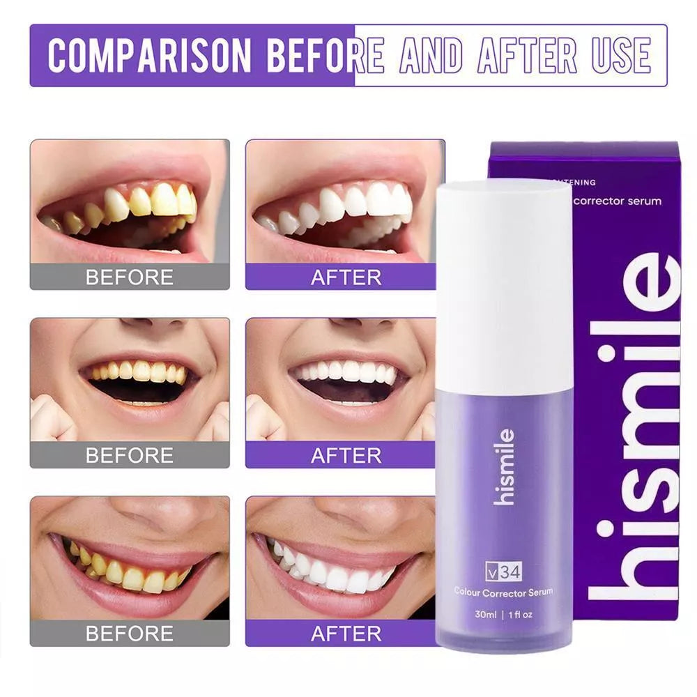 HiSmile Teeth Whitener