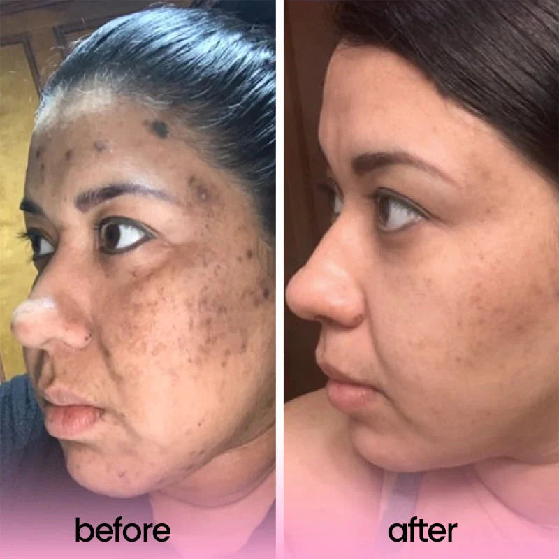 TURMERIC & KOJIC ACID PADS