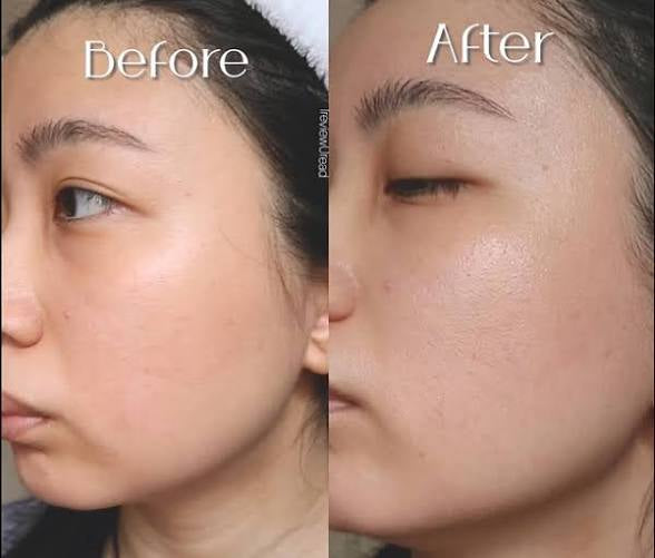 Sun Protection With Beauty Of Joseon Matte Sunstick